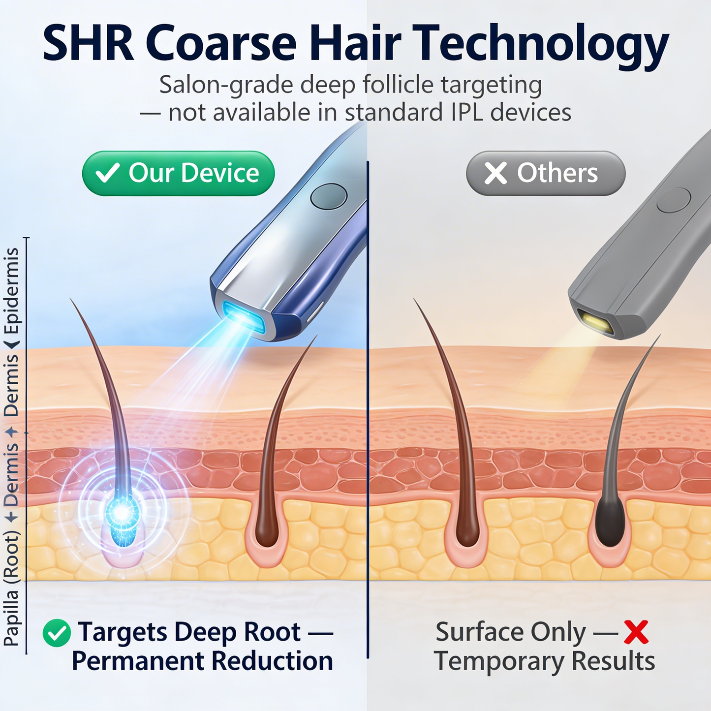 LumiVelvet Pro — Salon-Grade IPL Hair Removal Device